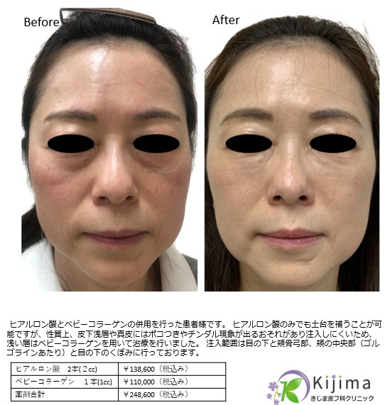 疲れて見える印象の改善モニター写真